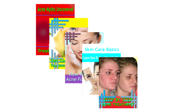 Beating Acne 5 Guides Collection,beating acne book,why is my pimple beating,beating hormonal acne